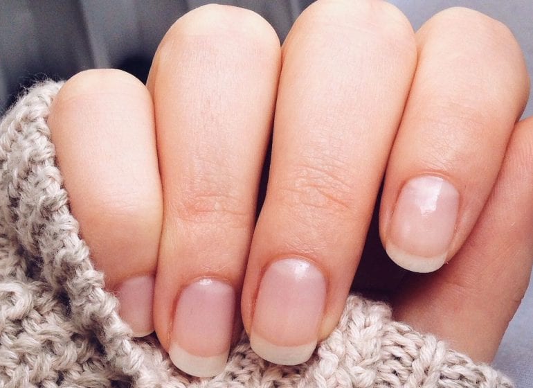 Ongles Abîmés Comment Les Soigner So Healthy